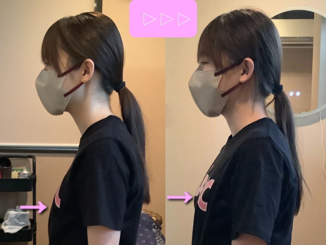 鍼灸サロン Lila(リーラ) 【その場で変化を実感】《通常》姿勢矯正＋鍼灸全身治療のメニュー画像