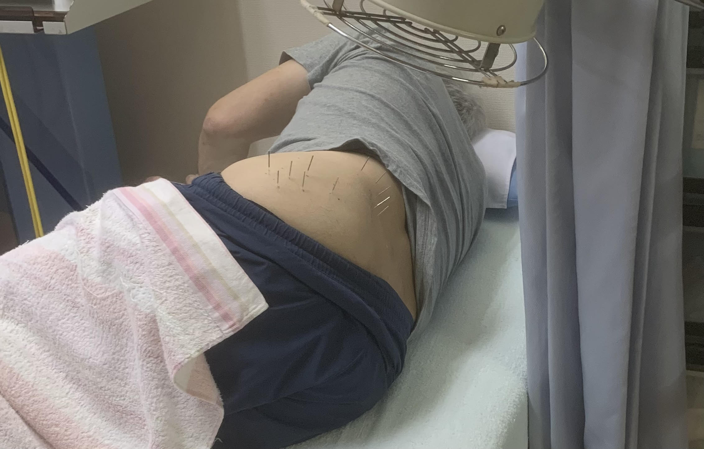 【腰痛専門】たなべ接骨院・はりきゅう院 【強い・急な】痛みがある腰痛の方のメニュー画像