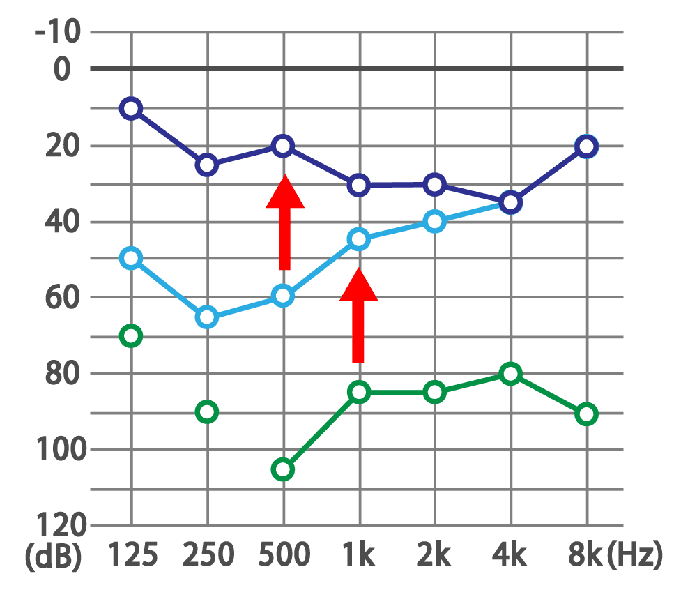 難聴・耳鳴り・腰痛・五十肩・薄毛・自律神経失調症ならお任せください!剛鍼灸院 新城(剛鍼灸院グループ) 難聴は時間との闘い!1日でも早く治療を始めましょうのメニュー画像