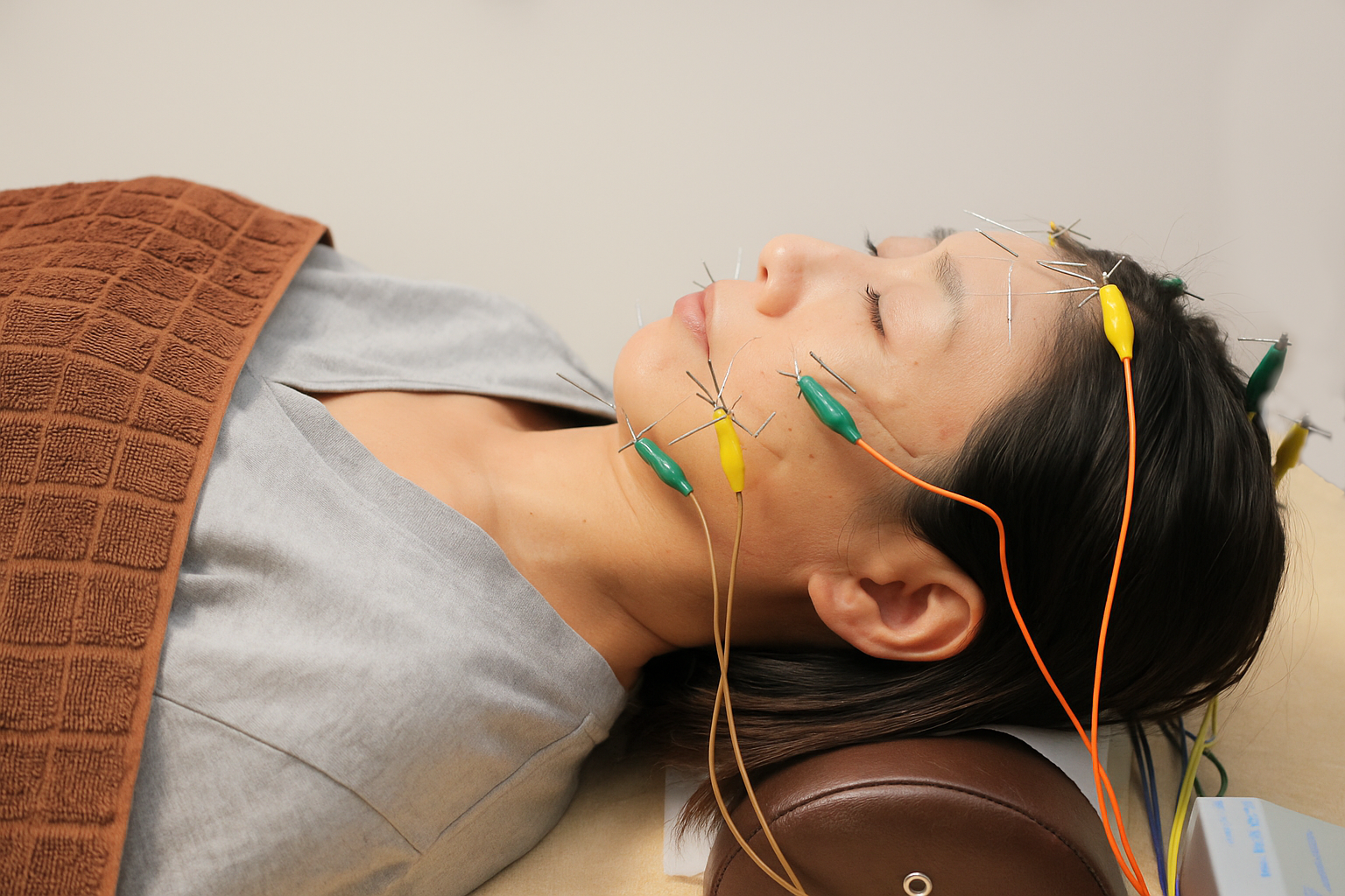 ごほう美鍼灸院 電気美容鍼本格コース　【今だけ】オープン記念特別価格！のメニュー画像
