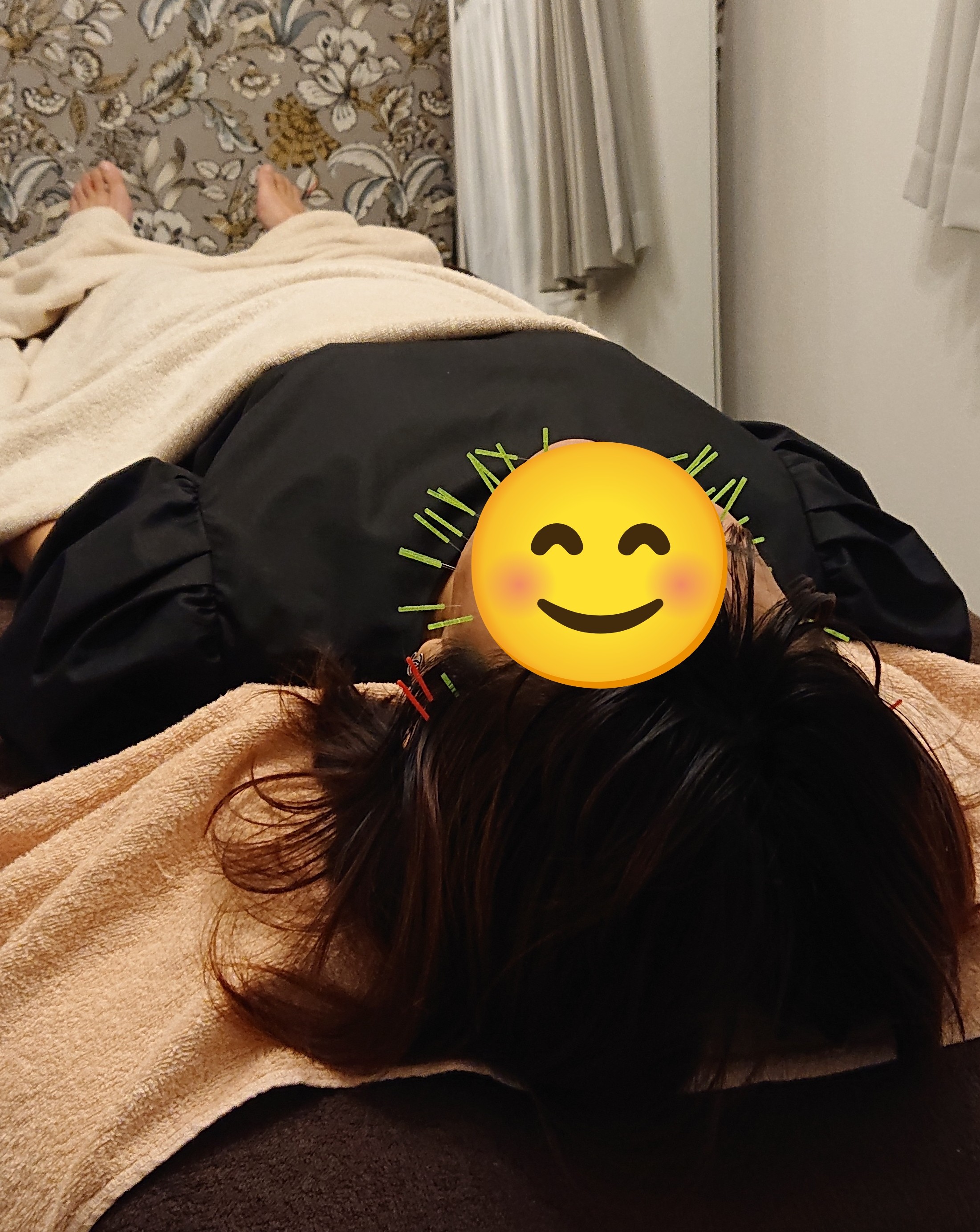 はり灸　Mysig 美容鍼灸のメニュー画像