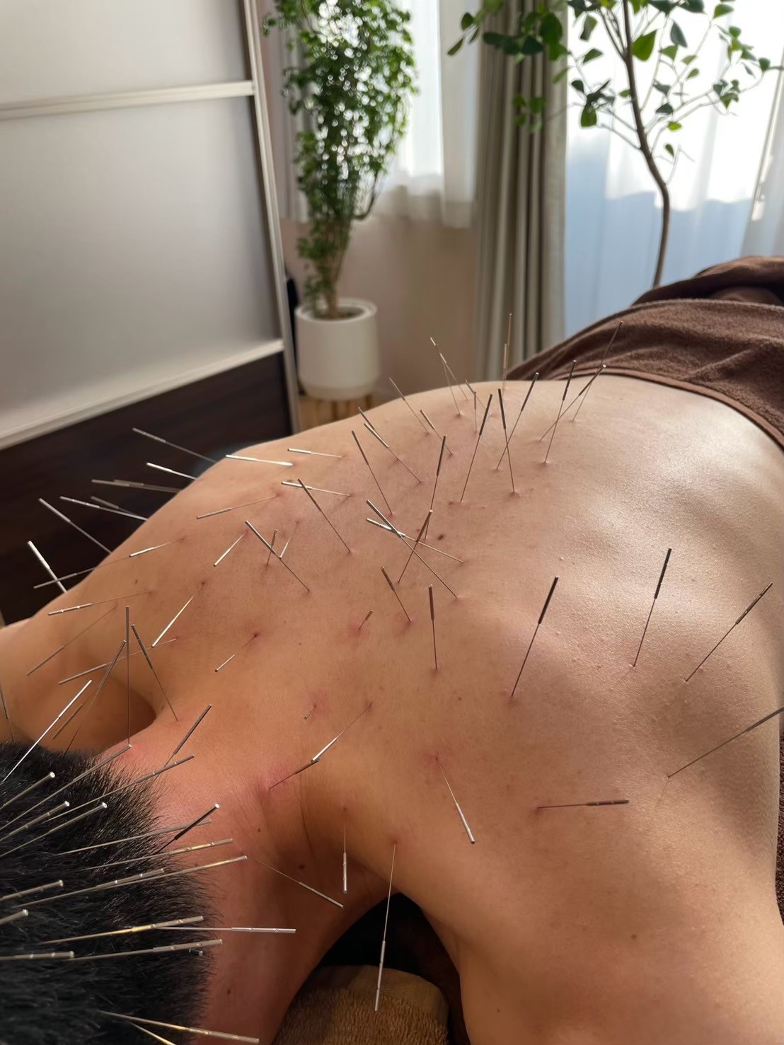 賢鍼灸院(ルート治療) ルート治療60分:スタンダードコース　　　　【初診/現金のみ】　　　　のメニュー画像