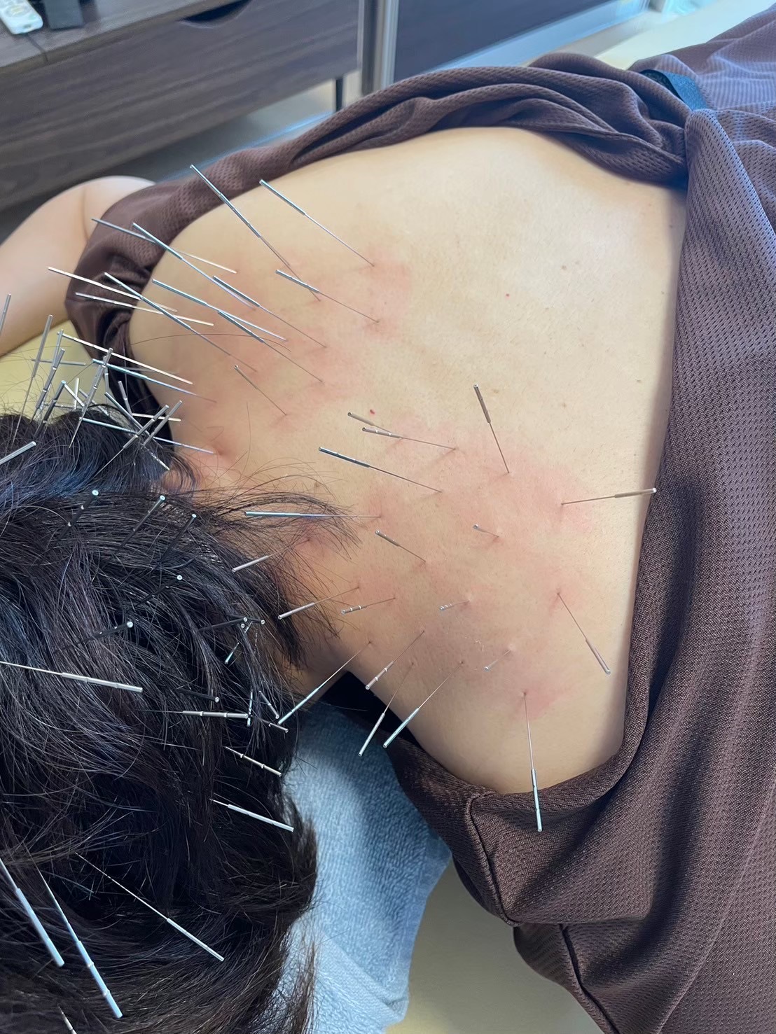 賢鍼灸院(ルート治療) ルート治療30分:ショートコース　　　　　【2回目以降/現金のみ】　のメニュー画像