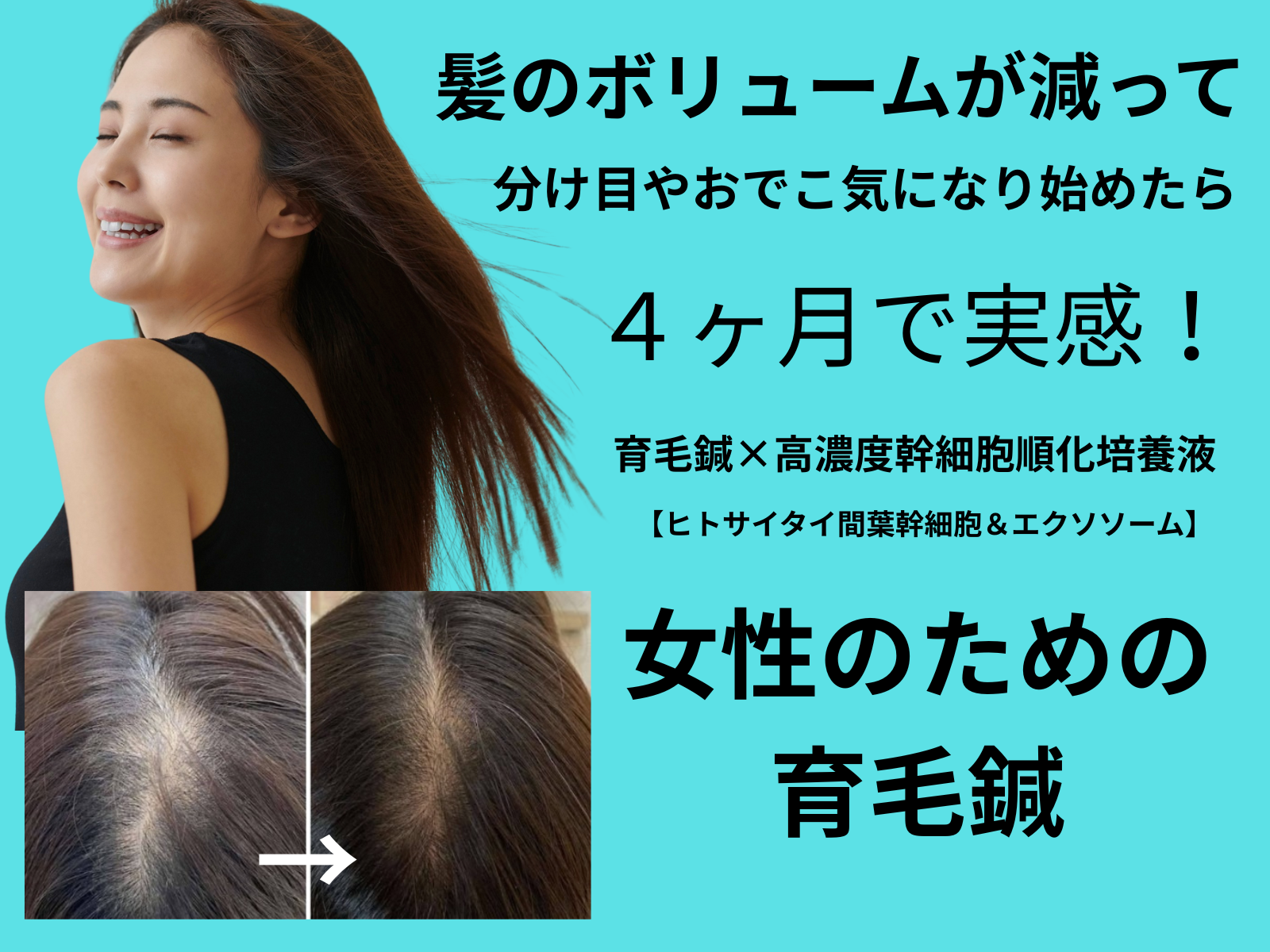 鍼灸整体サロンねこのひげ 【分け目が薄くなって恥ずかしい女性の薄毛改善育毛鍼】髪のボリュームUP 育毛鍼のメニュー画像