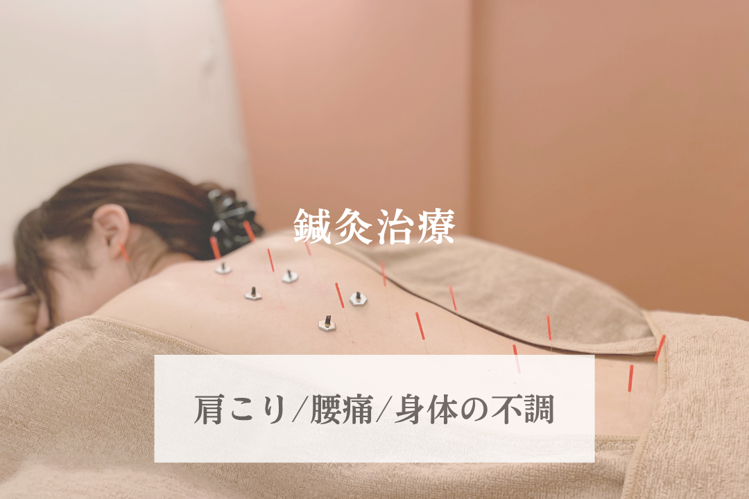 鍼灸マッサージサロンLa fonte 鍼灸治療(痛み)のメニュー画像