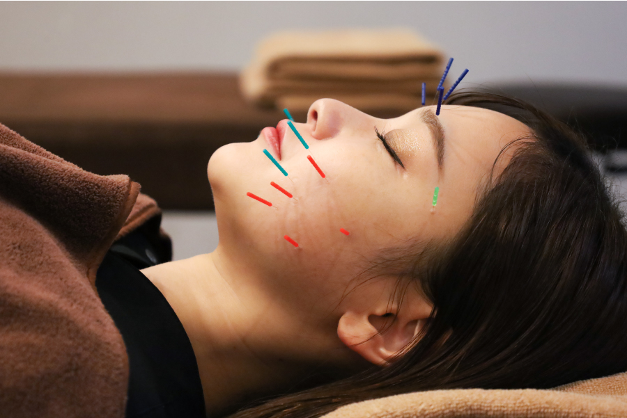 小林整骨院 三条 【女性人気No.1】整体×美容鍼×美顔器　身体とお顔を整える　9750円→3000円のメニュー画像