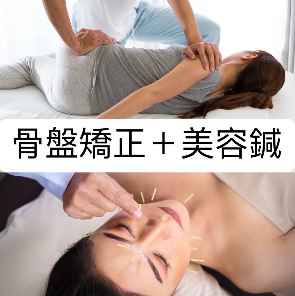 ヒューマン鍼灸接骨院 【体と顔同時に施術】　骨盤矯正+美容鍼　￥13300→¥6280のメニュー画像