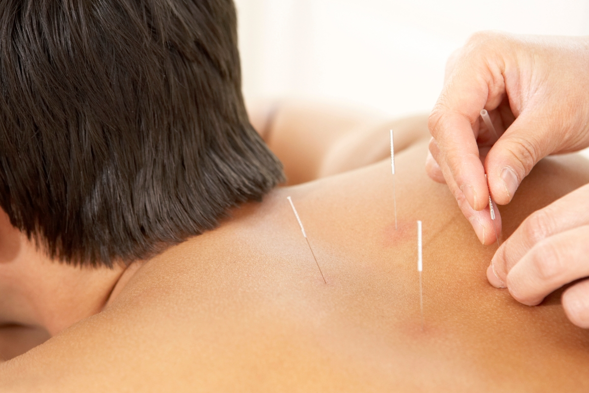 桶川朝日鍼灸院 鍼灸・首肩こり治療のメニュー画像