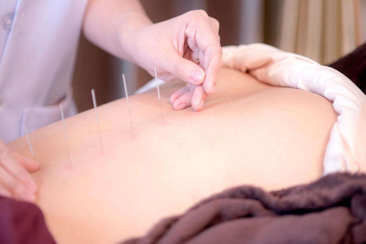 桶川朝日鍼灸院 鍼灸・腰痛治療のメニュー画像