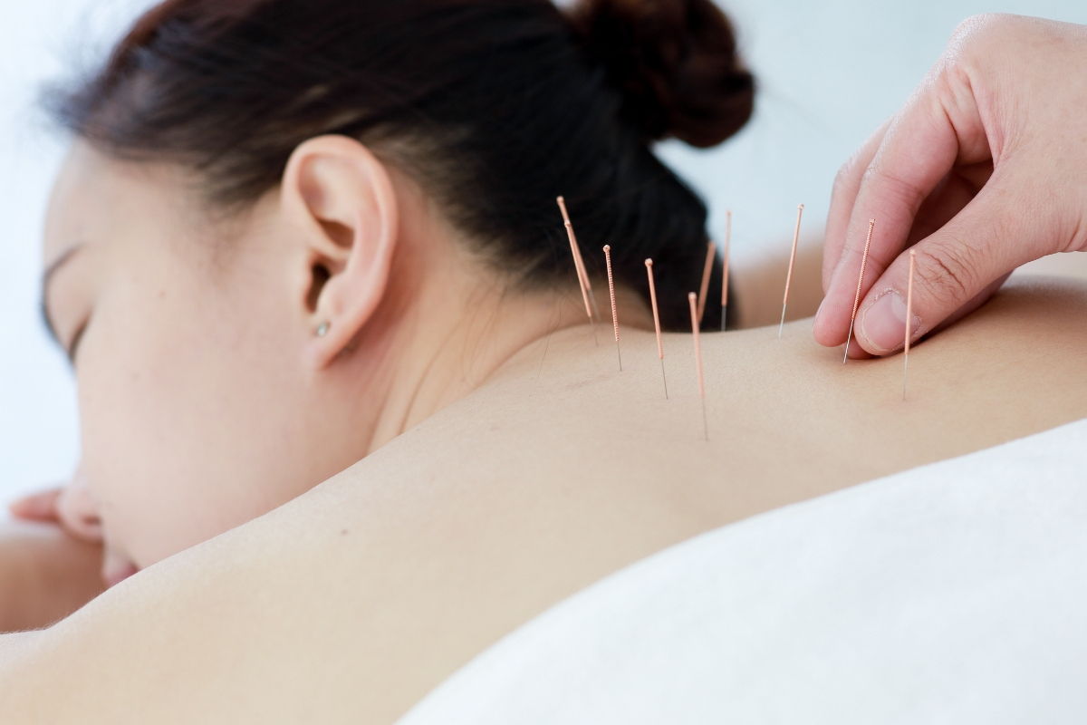 桶川朝日鍼灸院 鍼灸・自律神経失調症治療のメニュー画像