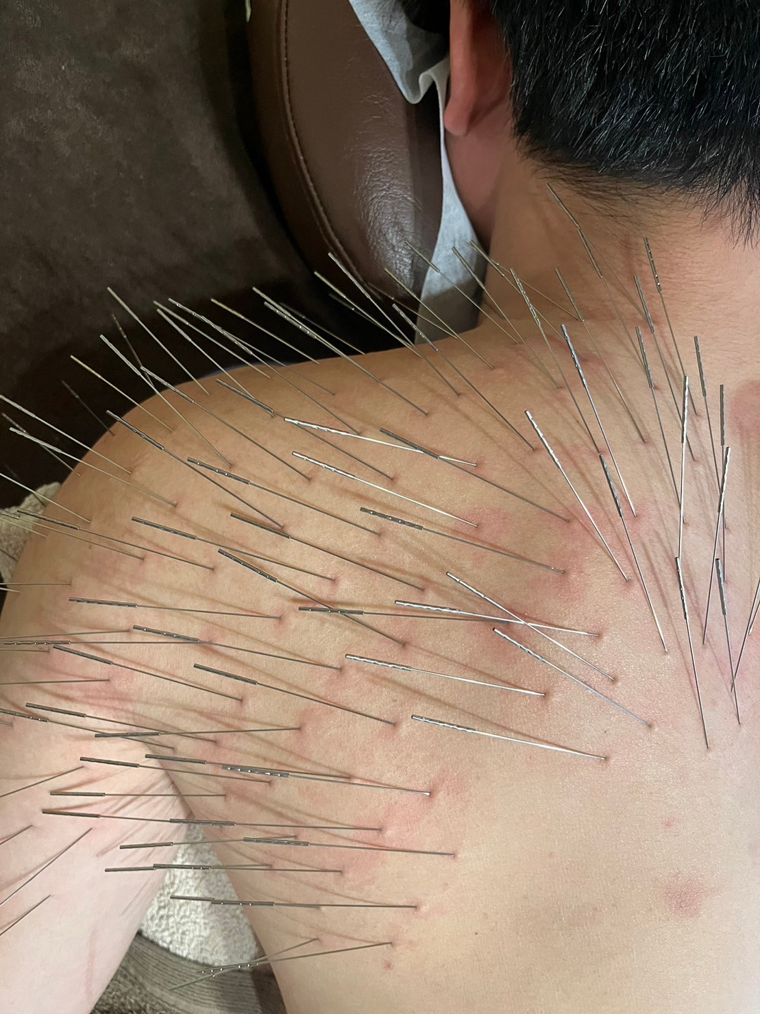 温春健心 ルート治療60分のメニュー画像