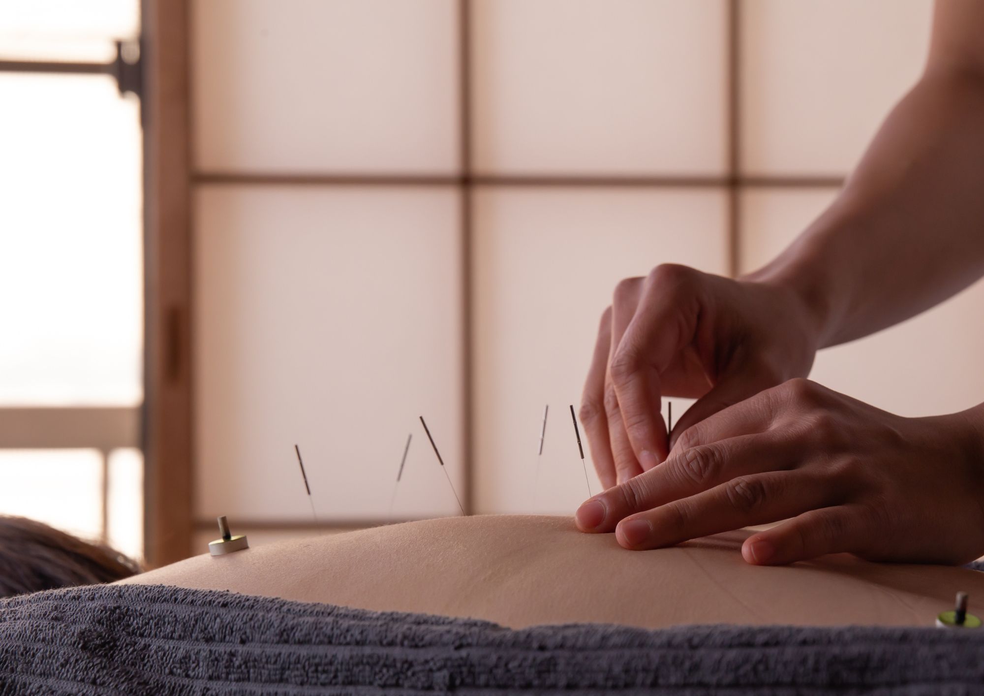 はり灸sueru＆YOGA 【鍼灸｜はじめて｜ベーシック１０５】のメニュー画像