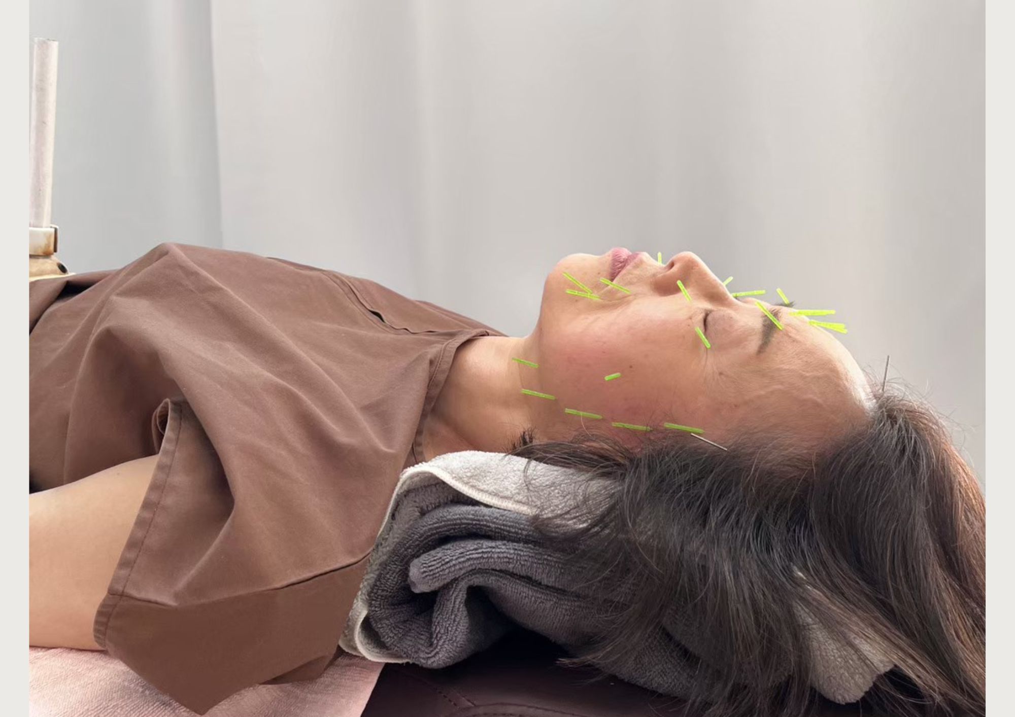 はり灸sueru＆YOGA 【鍼灸｜美容鍼灸】のメニュー画像