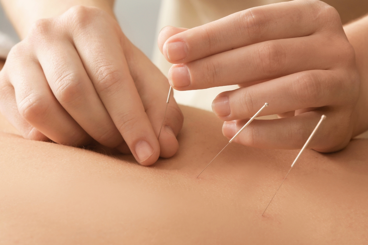 桶川朝日鍼灸院 鍼灸・不妊治療のメニュー画像