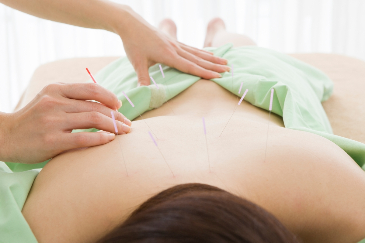 桶川朝日鍼灸院 鍼灸・全身治療のメニュー画像