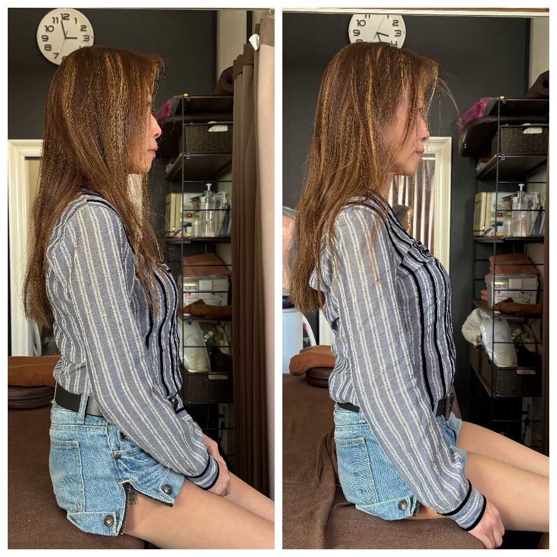 まつもと鍼灸院 美勢矯正　2回目以降のメニュー画像