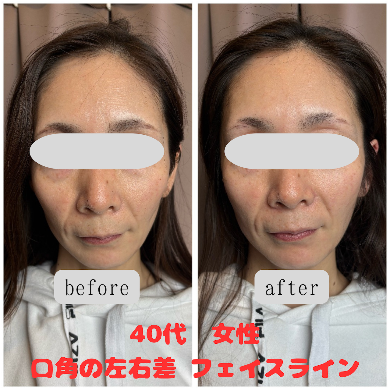 まつもと鍼灸院 美顔整体　2回目以降のメニュー画像