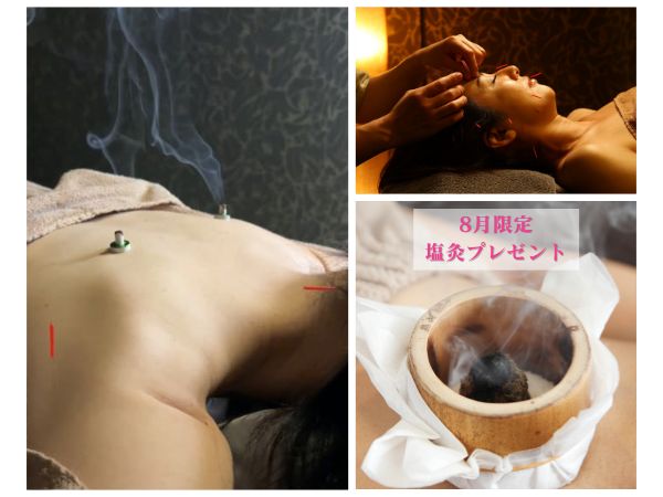 カリスタ恵比寿本店 【初回8月限定塩灸付き ／お顔＋お身体】美容鍼灸トライアルコースのメニュー画像