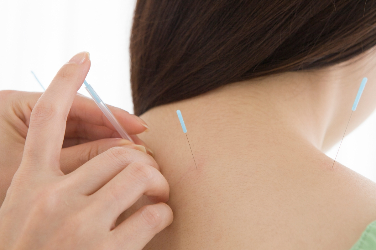 桶川朝日鍼灸院 追加・鍼灸治療【首肩こり・腰痛・関節痛・鍼灸部分治療　専用】のメニュー画像