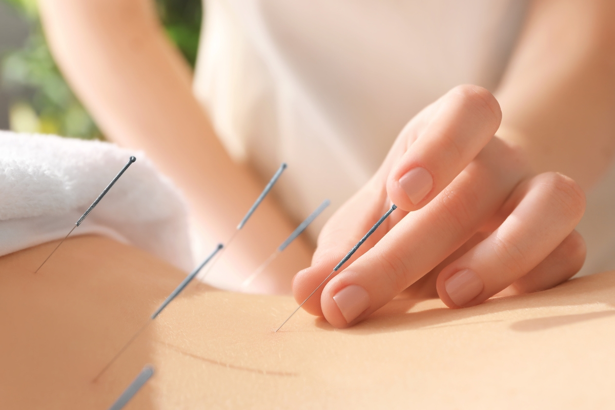 桶川朝日鍼灸院 追加・鍼灸全身治療【手技療法　専用】のメニュー画像