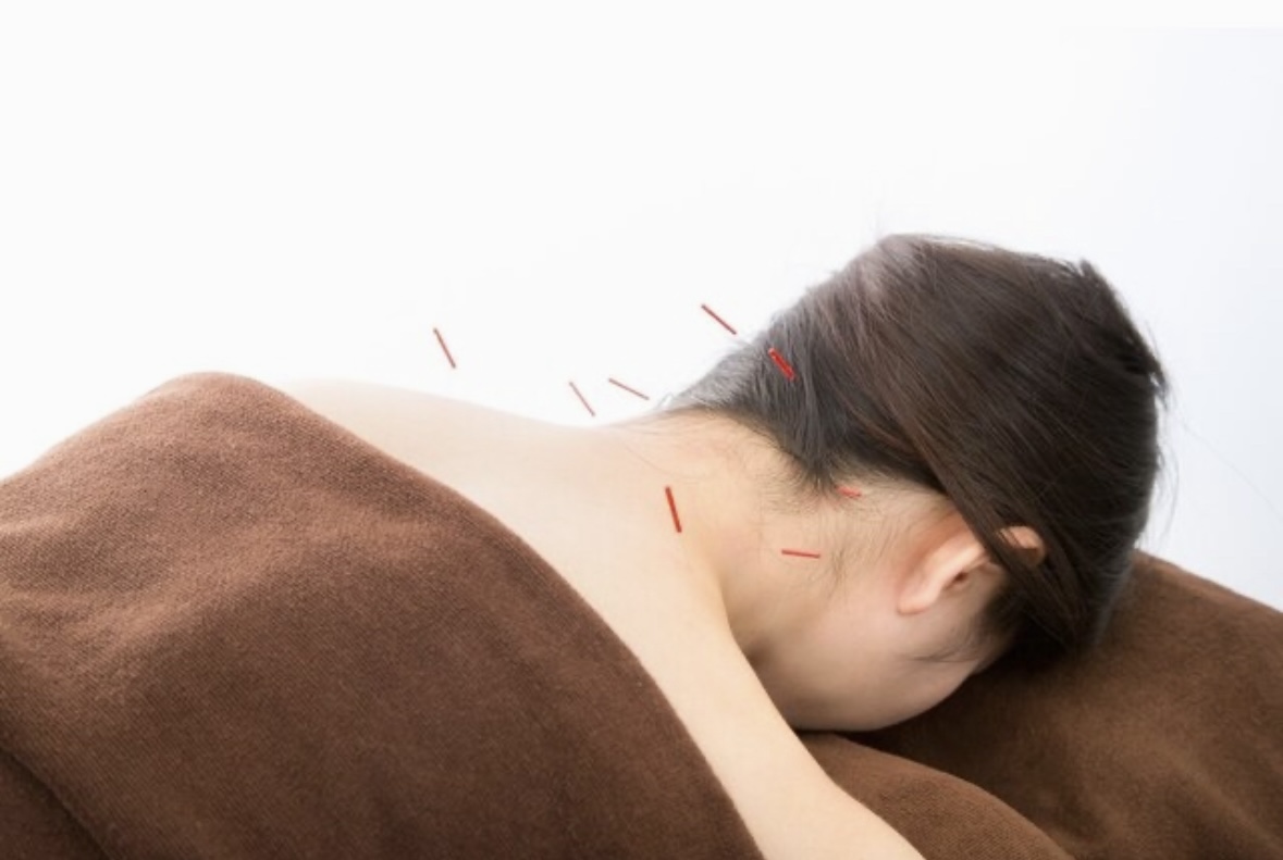 はり・きゅう　Petit Pas お試し鍼灸　60分　　こり、ハリ、冷え、夏の疲れなどの身体の不調に☆のメニュー画像