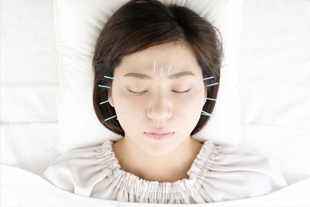 グレース鍼灸整骨院 【美容鍼×小顔コース】ツボ刺激で綺麗なフェイスラインへのメニュー画像