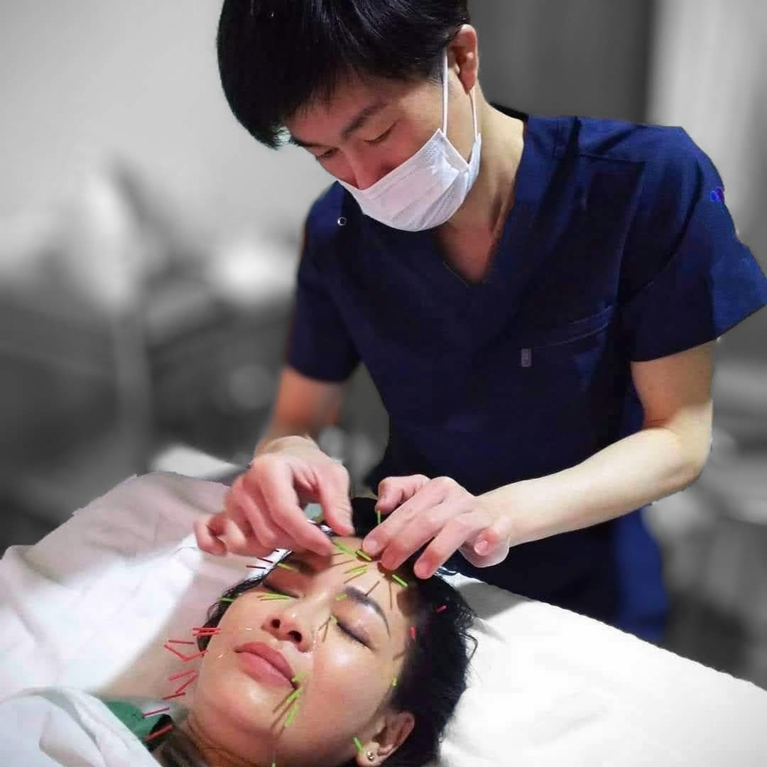 鍼灸 THALASSA ☓ からだちSTUDIO/鍼灸整骨院 美顔鍼（美顔マッサージ付）のメニュー画像