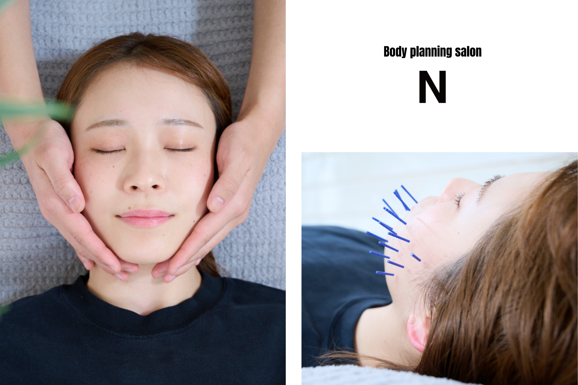 小顔&ダイエットBody planning salon N恵比寿店 【人気No. 2★】美容鍼100本＋小顔矯正＋フェイシャルリンパ　パルス施術付のメニュー画像