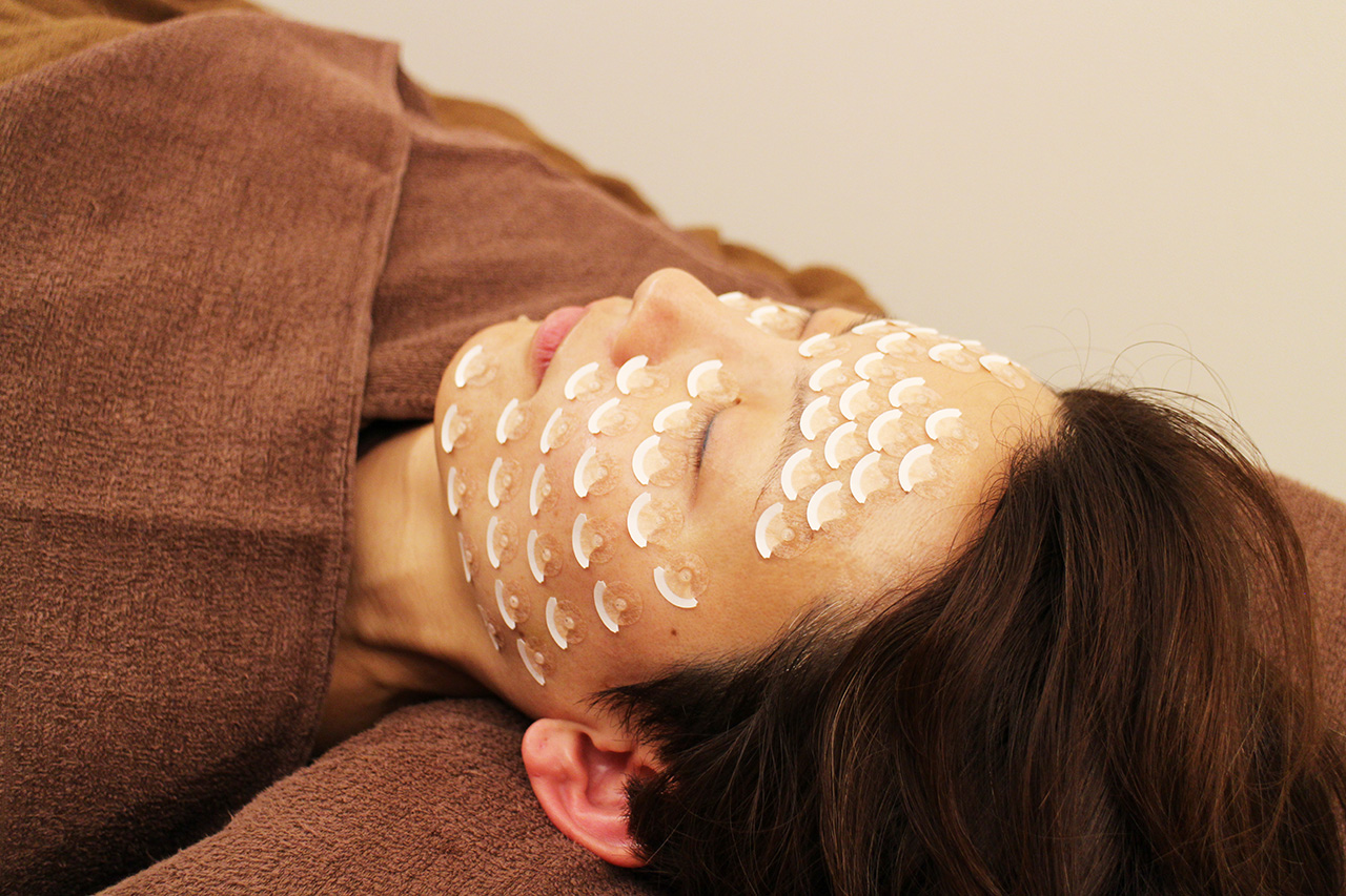 鍼灸×整体　salon i 【日本で当院のみ！】　龍鱗鍼　60分のメニュー画像