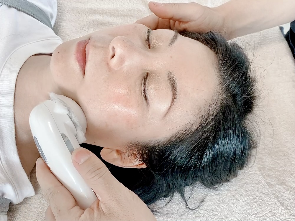 はり灸サロン　totonoi 小顔美容鍼のメニュー画像