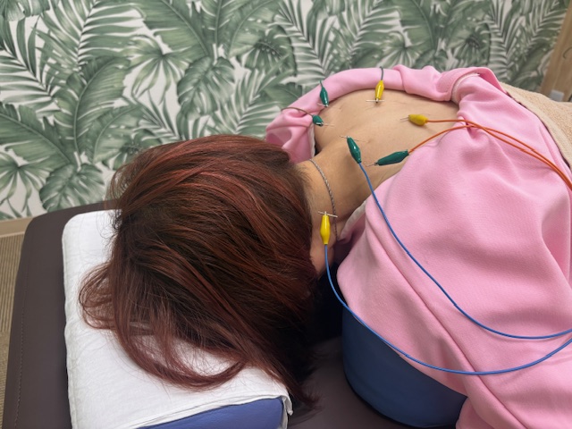 メディカルハンズ塚口鍼灸マッサージ院 鍼灸選べる１コース（くび肩・腰・膝・脚のむくみ・眼精疲労等）のメニュー画像