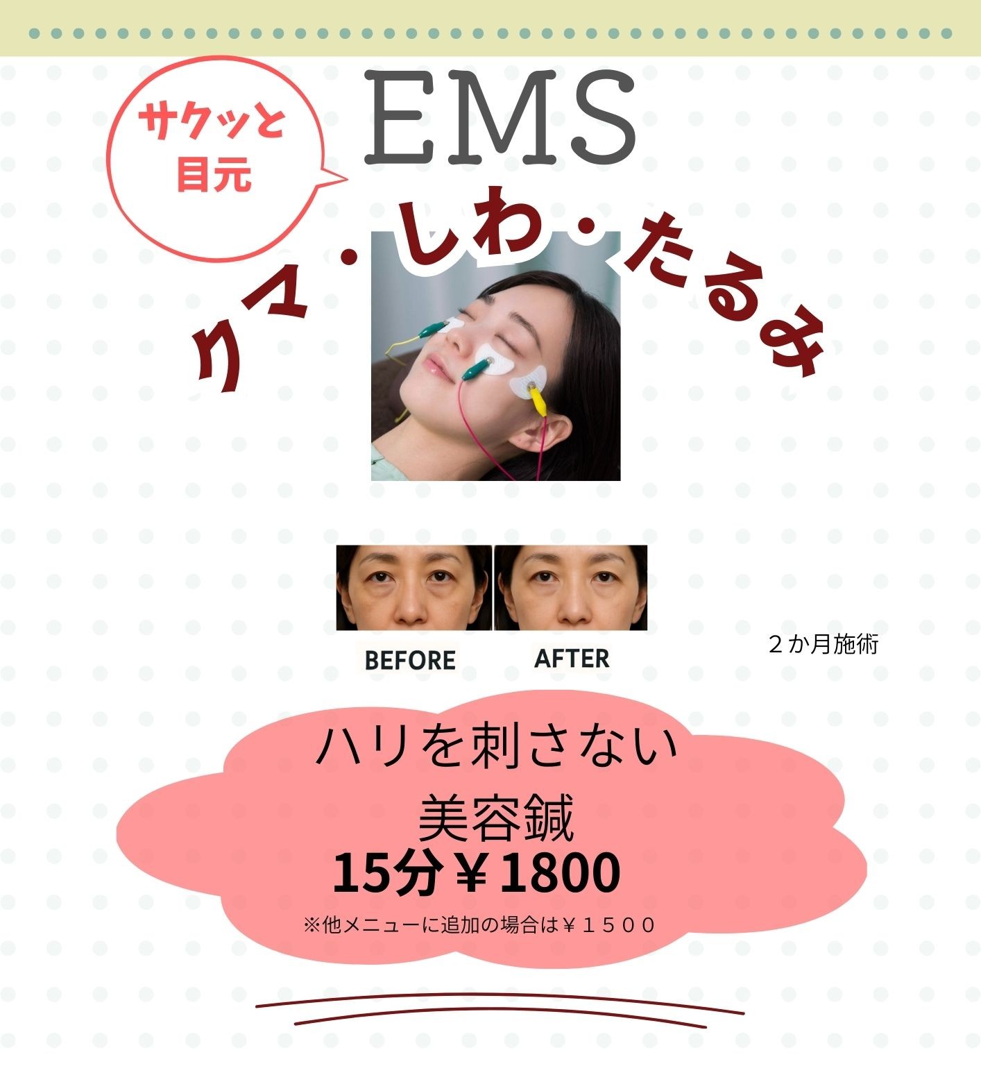 ふじおか鍼灸院 目元EMS【鍼をささない美容鍼灸】のメニュー画像