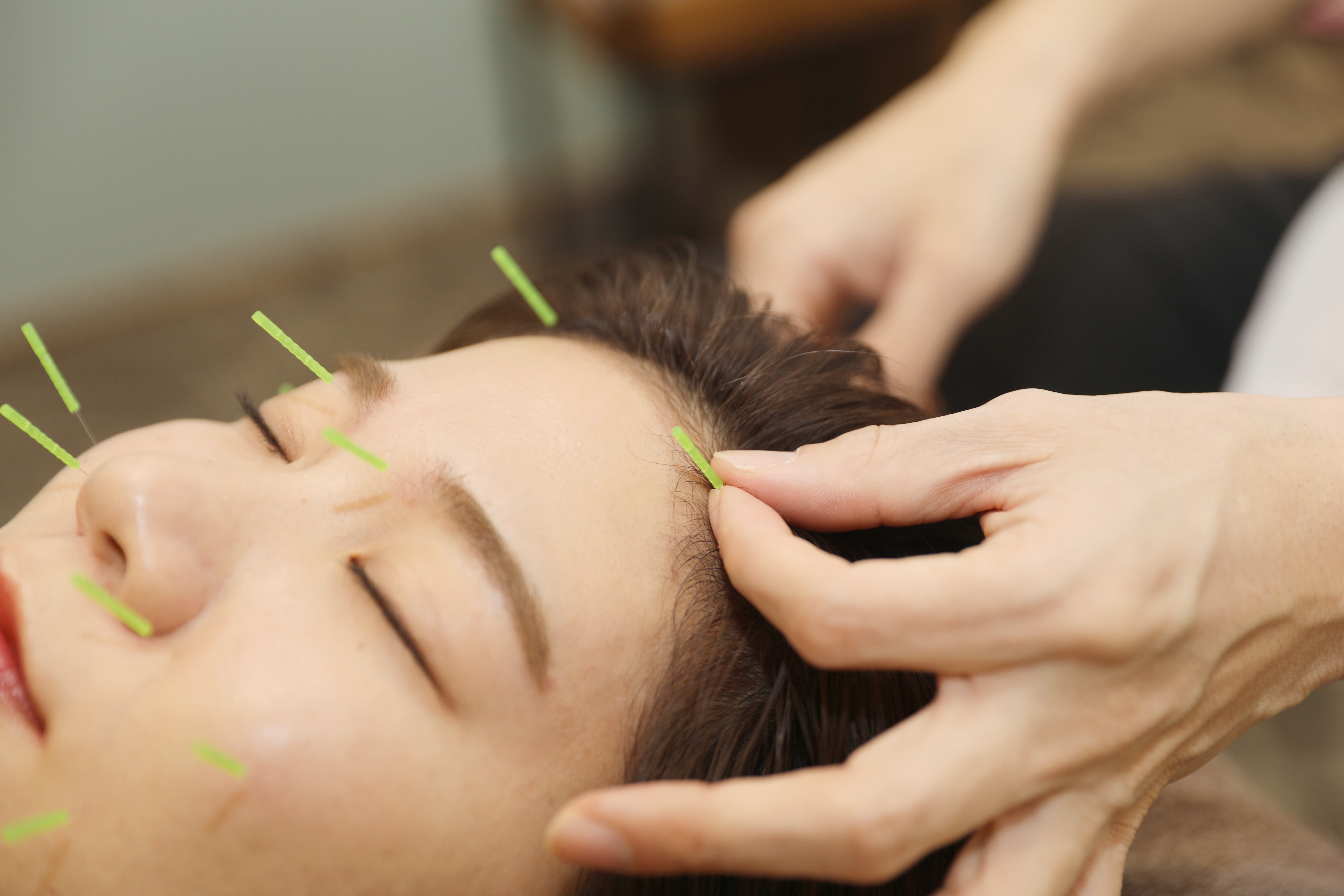 イーエックス鍼灸院 【スッキリした小顔に！】　むくみ・リフトアップ効果☆60分¥9,900→￥3,980のメニュー画像