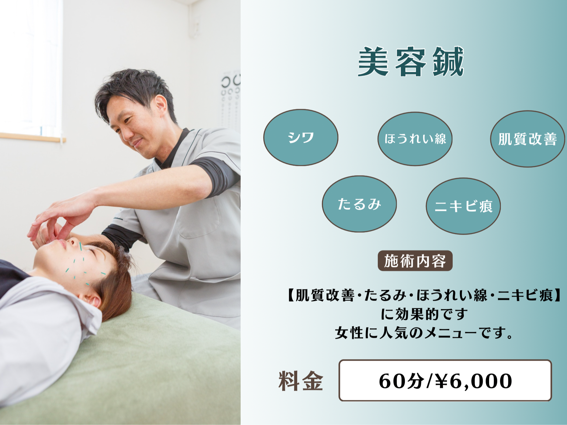 Conditioning Art 鍼灸院 美容鍼【お顔のたるみ・しわ・ほうれい線】に効果ありのメニュー画像