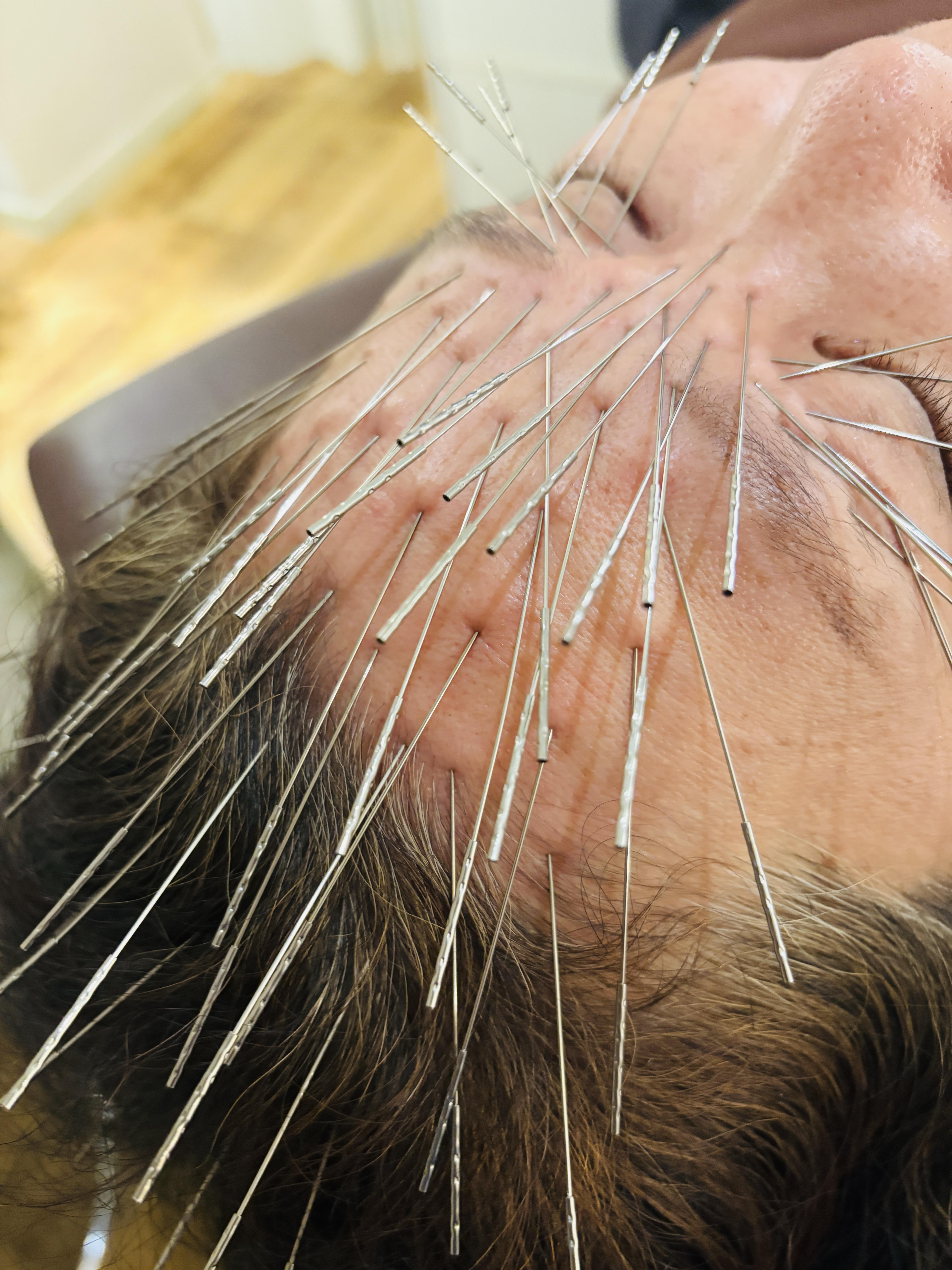 　【ルート治療専門院】　　　　はりきゅう 森の治療院 【Y様御用達】120分ルート治療×空ルートのメニュー画像