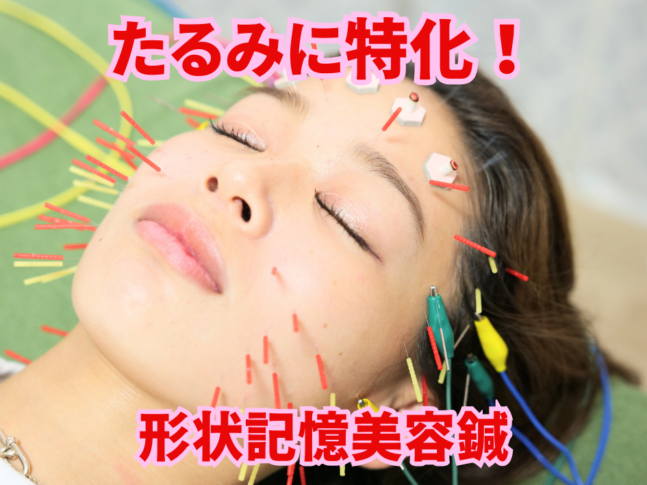 美顔鍼灸整体院凛と慶 【残３名→1名募集】たるみ肌改善:形状記憶美容鍼プログラム初回体験のメニュー画像