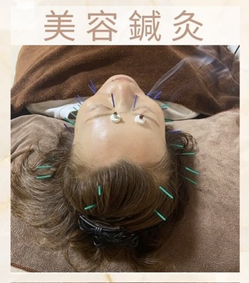 〜ARiSH〜骨盤調整＆はり灸 美顔鍼灸のメニュー画像