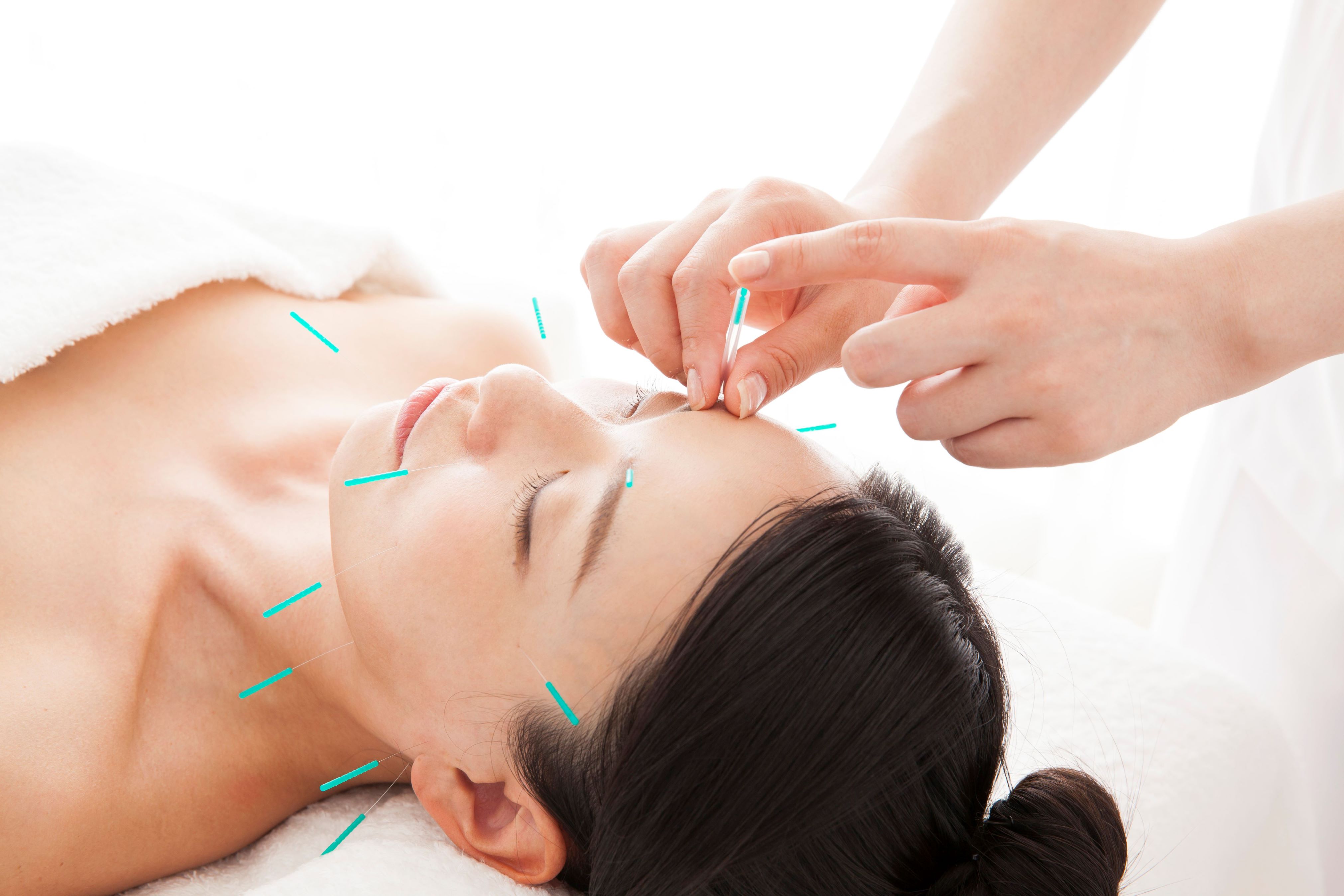 レディース鍼灸治療院Sis.学園前本院 電気を流す美容鍼のメニュー画像