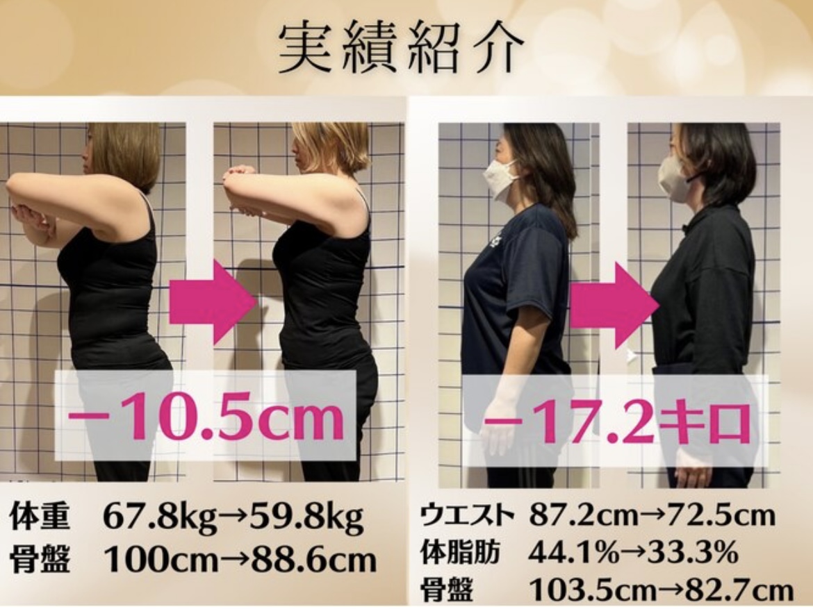 HARIS美容鍼灸整体院 【残り1名様】迷ったらこれ！平均5～8kg減量【痩身鍼灸＋ダイエット】90日の本気プログラムのメニュー画像