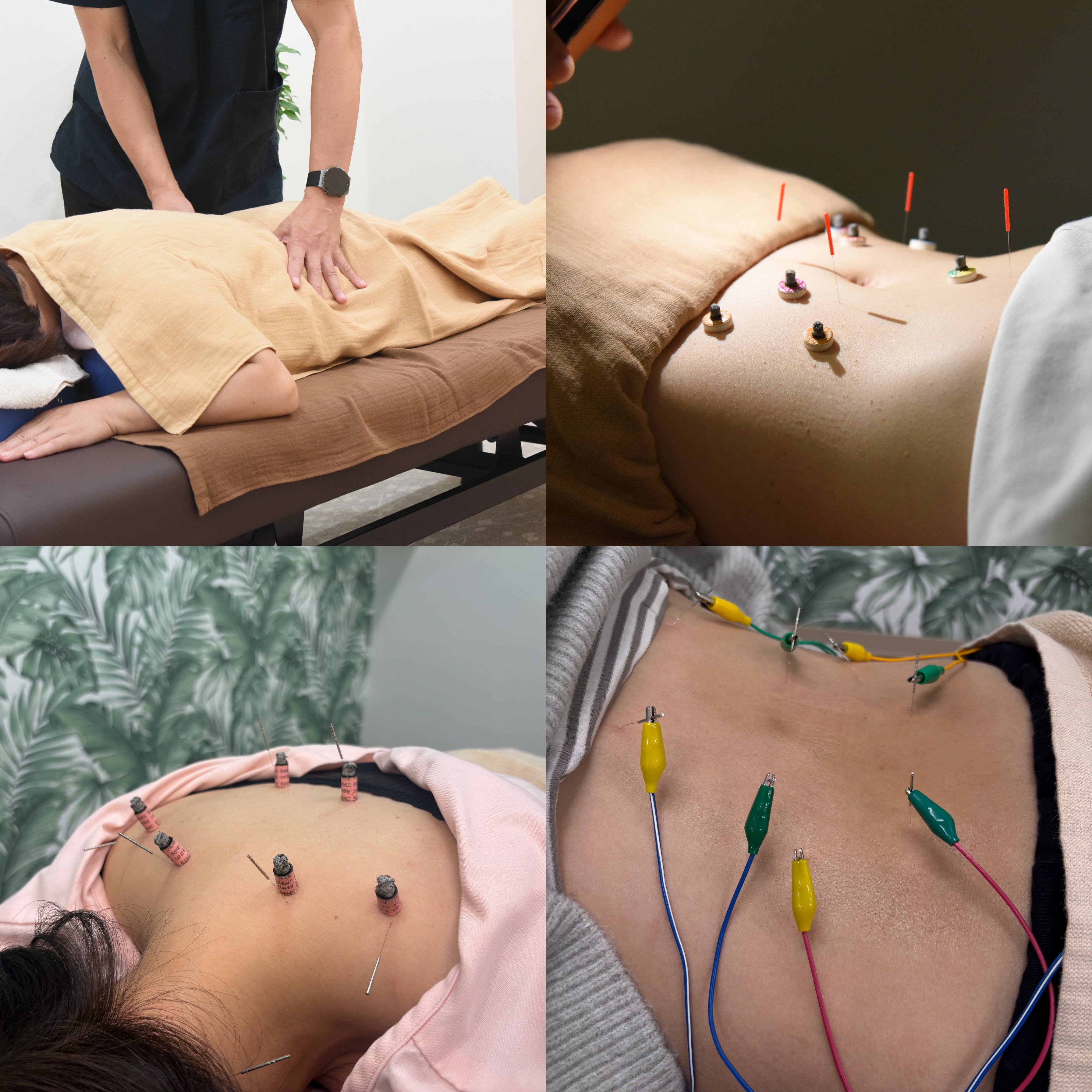 メディカルハンズ塚口鍼灸マッサージ院 総合治療　(院長)のメニュー画像