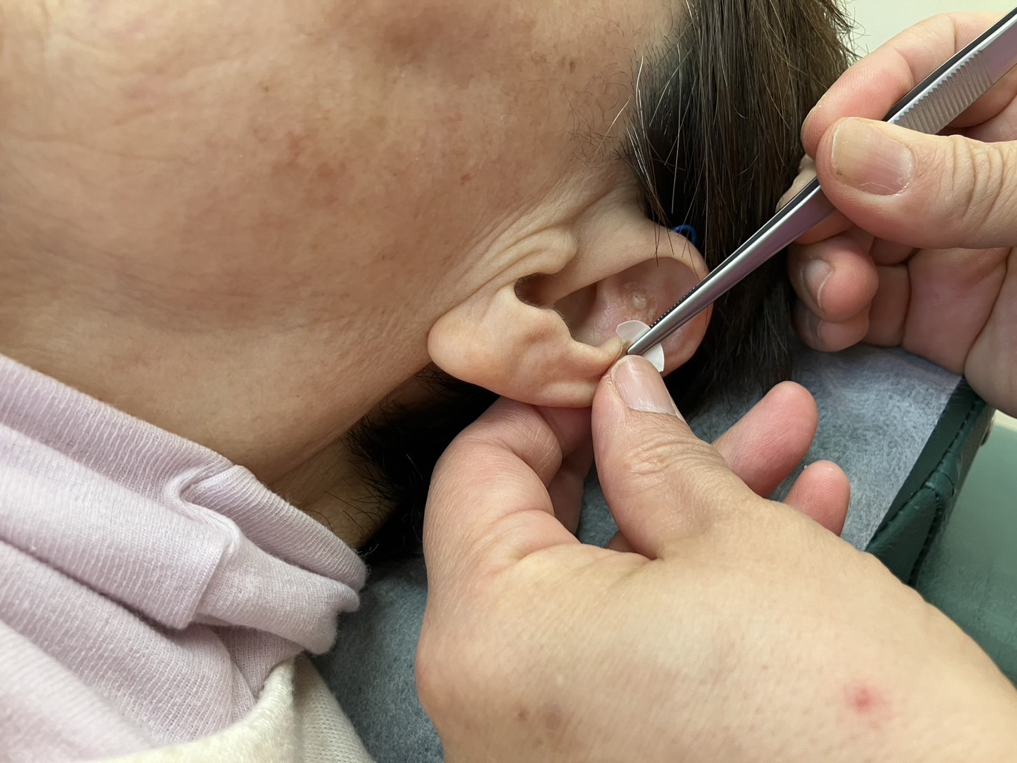 まき鍼灸院・柔道整復院 初回限定！　耳介画像全身はりきゅうのメニュー画像