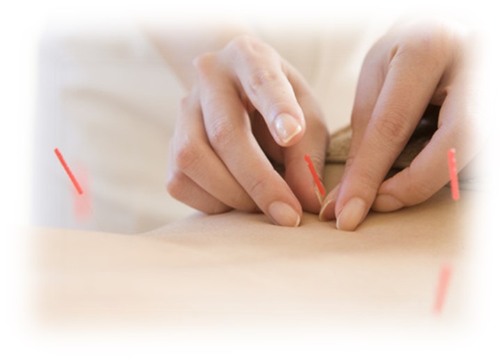 まき鍼灸院・柔道整復院 初回限定！整えはり+ほぐしコース　●今の症状を和らげたい方におすすめ！のメニュー画像