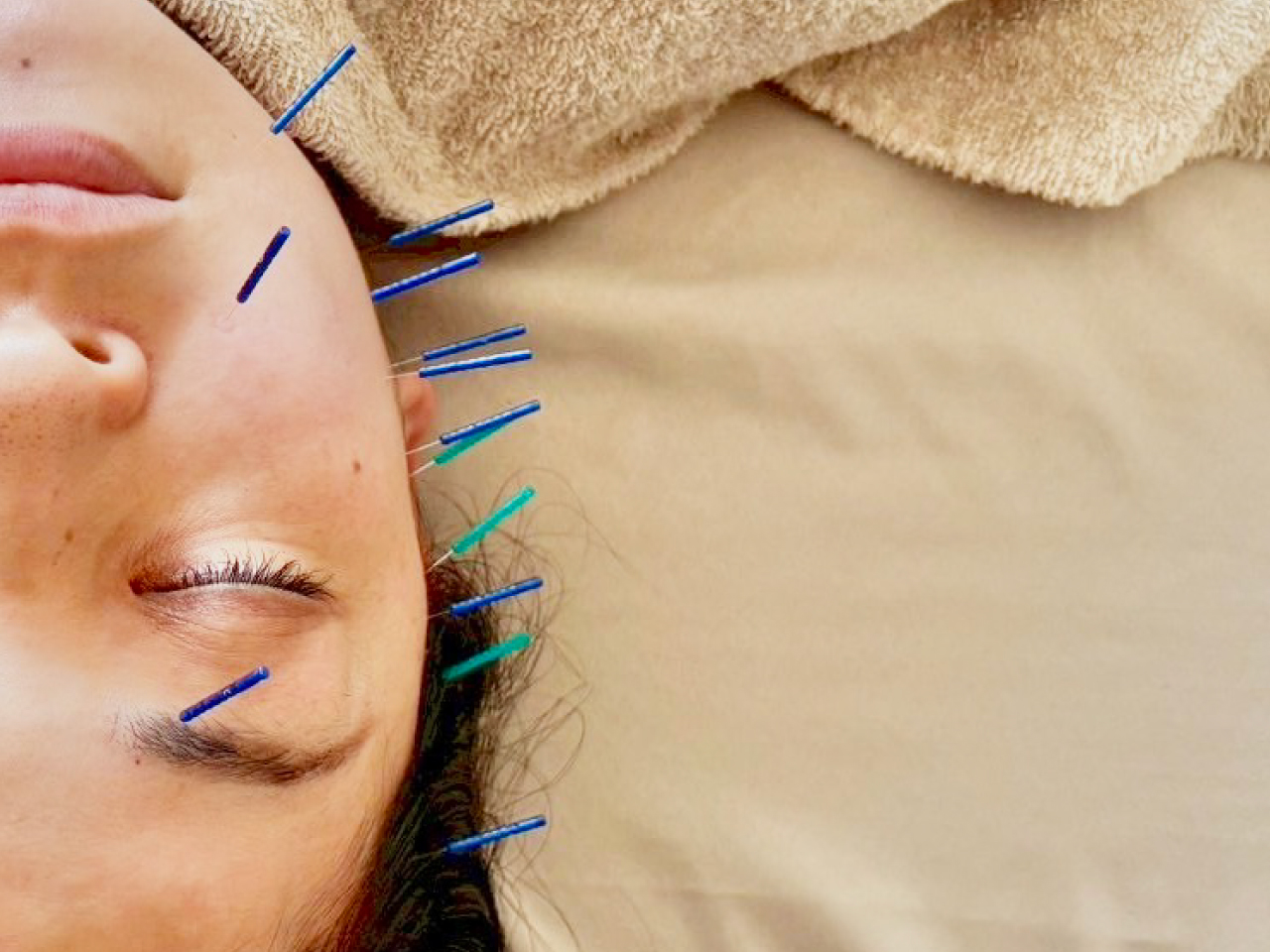 るるはり灸 きほんのはり灸治療＋美容はりのメニュー画像