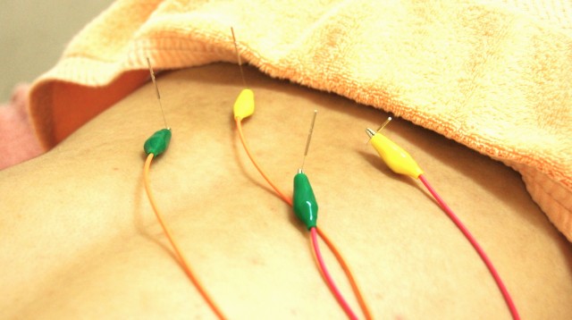 ふじおか鍼灸院 ✨クイック腰パルス（15分でサクッと腰から全身リセット）のメニュー画像