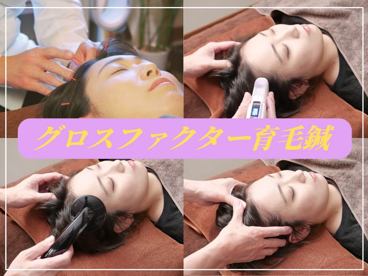 薄毛・抜け毛専門の鍼灸治療院レメディ 【初回】グロスファクター育毛鍼（成長因子）のメニュー画像
