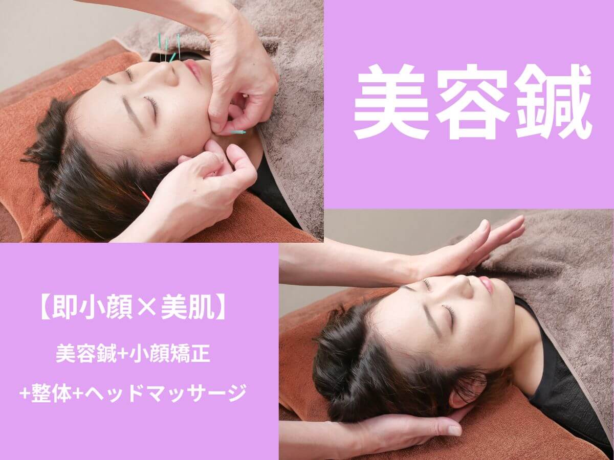 薄毛・抜け毛専門の鍼灸治療院レメディ 【初回】美容鍼＋小顔矯正のメニュー画像