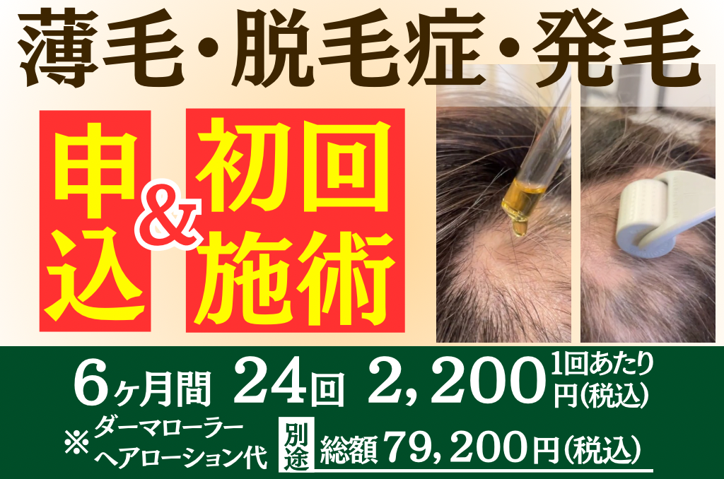 肌リジェ高崎（和香堂はり灸マッサージ治療院 内） 薄毛・脱毛症・発毛 6ケ月24回【初回】申込＆初回施術のメニュー画像