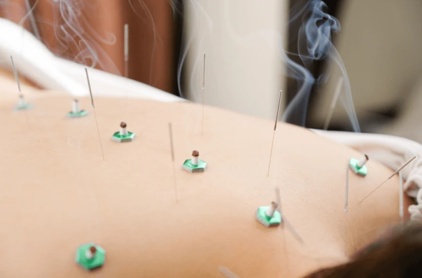 セドナ鍼灸治療院【自律神経失調症・マタニティ鍼灸】 自律神経鍼灸のメニュー画像