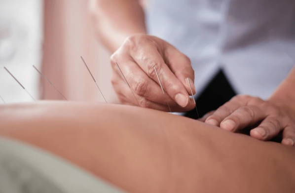 セドナ鍼灸治療院【自律神経失調症・マタニティ鍼灸】 一般鍼灸のメニュー画像