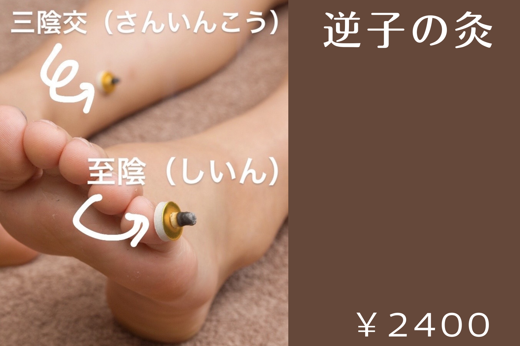 沖縄県那覇市首里スマイル鍼灸整骨院　本院 逆子のお灸のメニュー画像